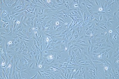 Human Cardiomyocytes, #AC16