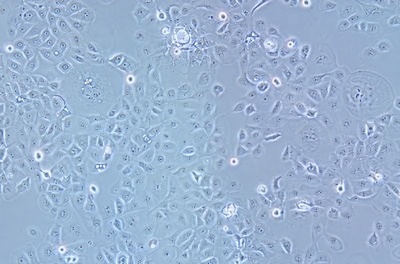 Human Breast Cancer Cell, #HCC1937
