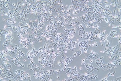 Human Gastric Carcinoma Cell, #MKN-74
