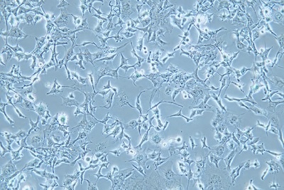 Human Gastric Carcinoma Cell, #HS746T