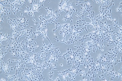 Human Oesophageal Epithelial Cell Line, #HET-1A
