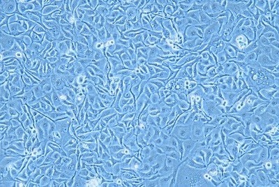 Human Oesophageal Squamous Cell Carcinoma, #KYSE-410