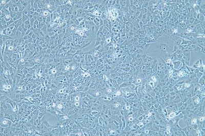 Human Normal Thyroid Cell Line, #NTHY-ORI 3-1