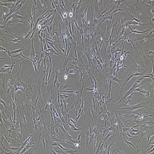 Human Splenic Fibroblast Cell Line, #BJ