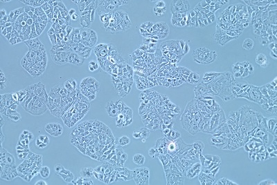 Human Breast Cancer Cell, #MDA-MB-415