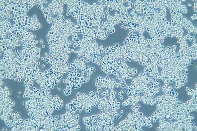 Human Gastric Carcinoma Cell, #MKN-45