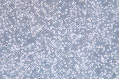 Acute Promyelocyte Cell Lines, #NB 4