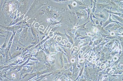 Human Normal Liver Cell Line, #THLE-2 (NOT AVAILABLE)