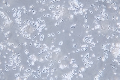 Human Brain Medulloblastoma Cell Line, #D341 MED
