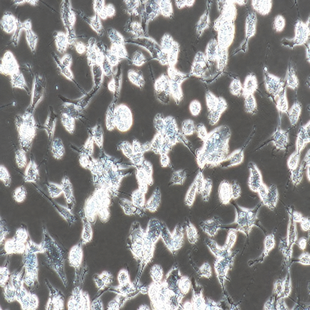 Human Breast Cancer Cell, #MDA-MB-436