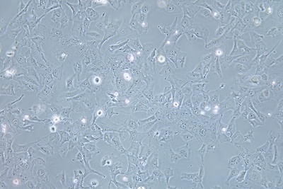 Human Breast Ductal Cancer Cell Line, #HCC 38