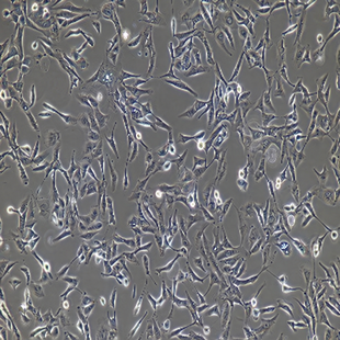 Human Microvascular Endothelial Cell Lines, #HMEC-1