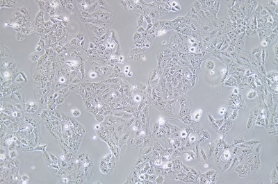 Human Ovarian Cancer Adenocarcinoma Cells, OVCAR-8