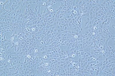 Human Chorionic Trophoblast Cell Line, #HTR-8/SVNEO