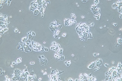 Human Esophageal Cell Line, #OE19