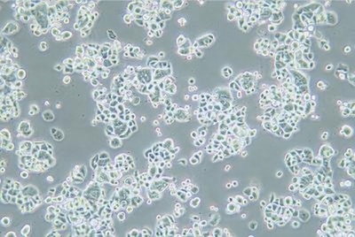 Human Breast Cancer Cell, #ZR-75-30