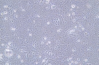 Human Breast Cancer Cell, #JIMT-1