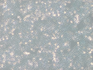Human Bladder Cancer Cell Line, #RT112