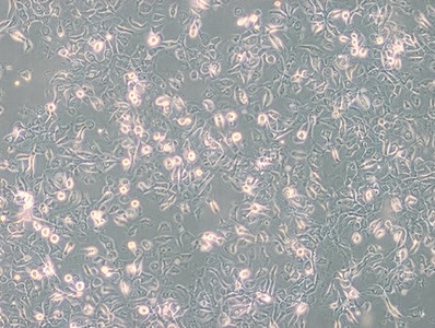 Human Breast Cancer Cell, #SUM149PT