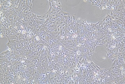 Human Oesophageal Squamous Carcinoma Cell Line, #KYSE-140