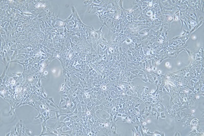 Human Esophageal Cancer Cell Line, #TE-10
