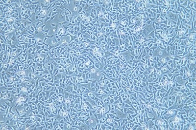 Human Oesophageal Squamous Cell Carcinoma Cell Line, #KYSE-180