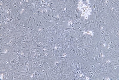 Human Oesophageal Squamous Carcinoma Cell Line, #KYSE-520