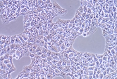Human Oesophageal Squamous Cell Carcinoma Cell Line, #KYSE-510
