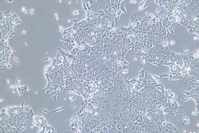 Human Esophageal Cell Line, #OE33
