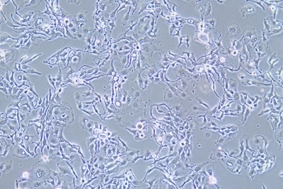 Human Breast Cancer Cell, #BT-20