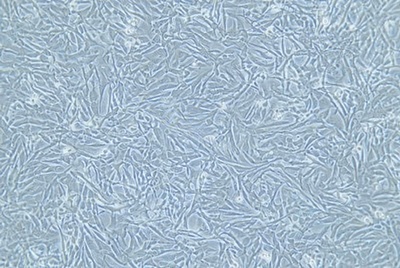 Human Breast Cancer Cell, #SUM159PT