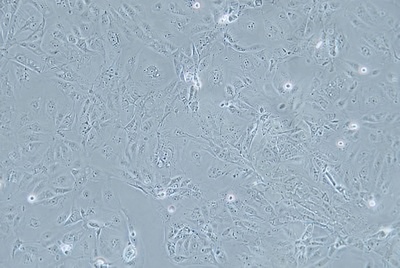 Human Gastric Carcinoma Cell, #MKN-7