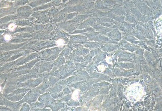 Primary Rabbit Adrenal Cortical Cells (ADCC)