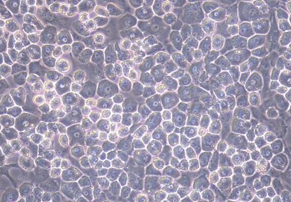 Primary Mouse Articular Chondrocytes (AC)