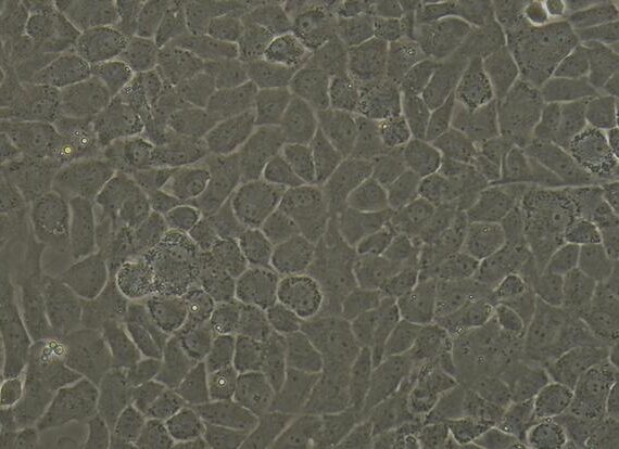 Primary Rat Articular Chondrocytes (AC)