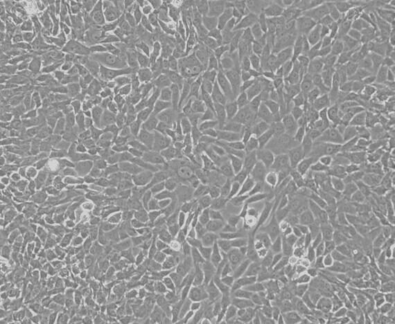 Primary Rabbit Articular Chondrocytes (AC)