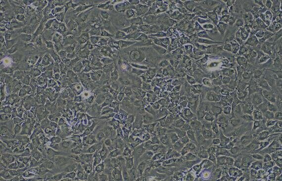 Primary Rabbit Cardiac Microvascular Endothelial Cells (CMEC)