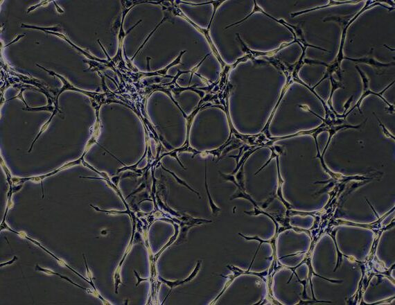 Primary Mouse Aortic Endothelial Cells (AEC)