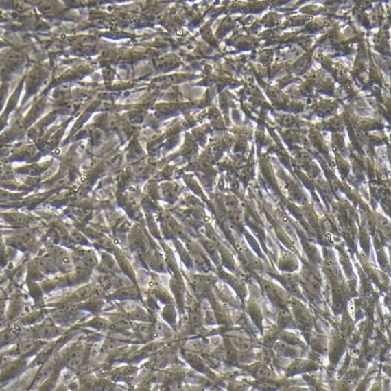 Primary Rat Aortic Endothelial Cells (AEC)