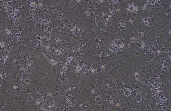 Primary Mouse Myocardial Cells (MC)