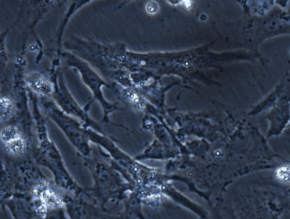 Primary Rat Myocardial Cells (MC)