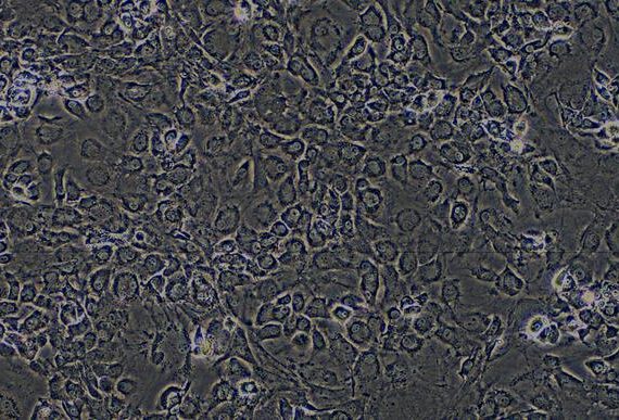 Primary Mouse Annulus Fibrosus Cells (AFC)