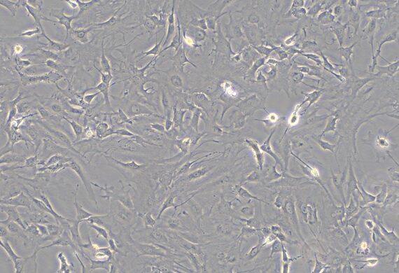 Primary Mouse Retinal Astrocytes (RA)