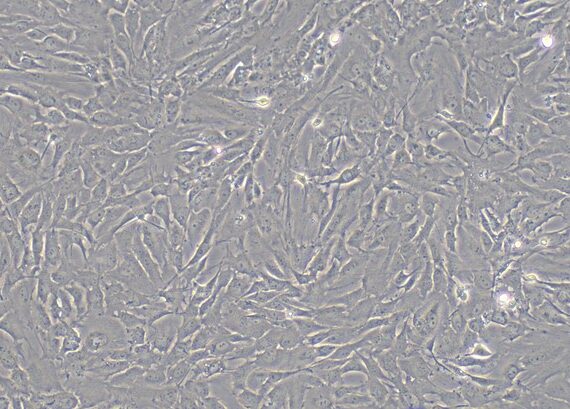 Primary Rabbit Retinal Astrocytes (RA)