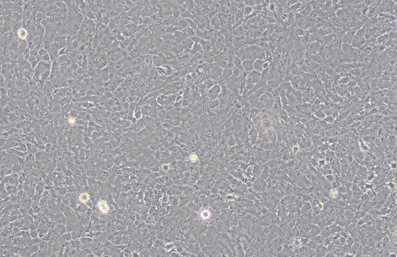 Primary Mouse Brain Astrocytes (BA)