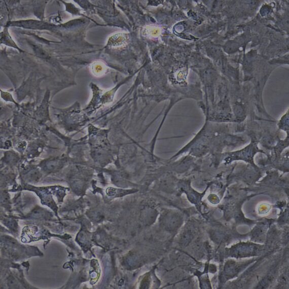 Primary Rat Brain Astrocytes (BA)