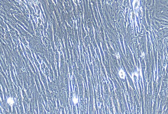 Primary Human Umbilical Mesenchymal Stem Cells (UMSC)