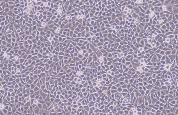 Primary Human Umbilical Vein Endothelial Cells (UVEC)