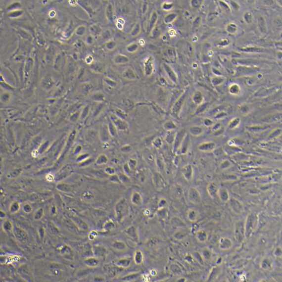 Primary Mouse Umbilical Vein Endothelial Cells (UVEC)