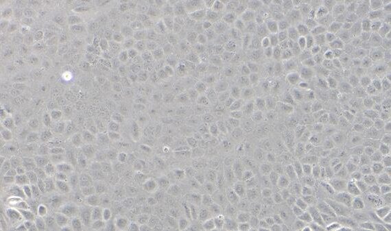 Primary Rabbit Corneal Epithelial Cells (CEC)